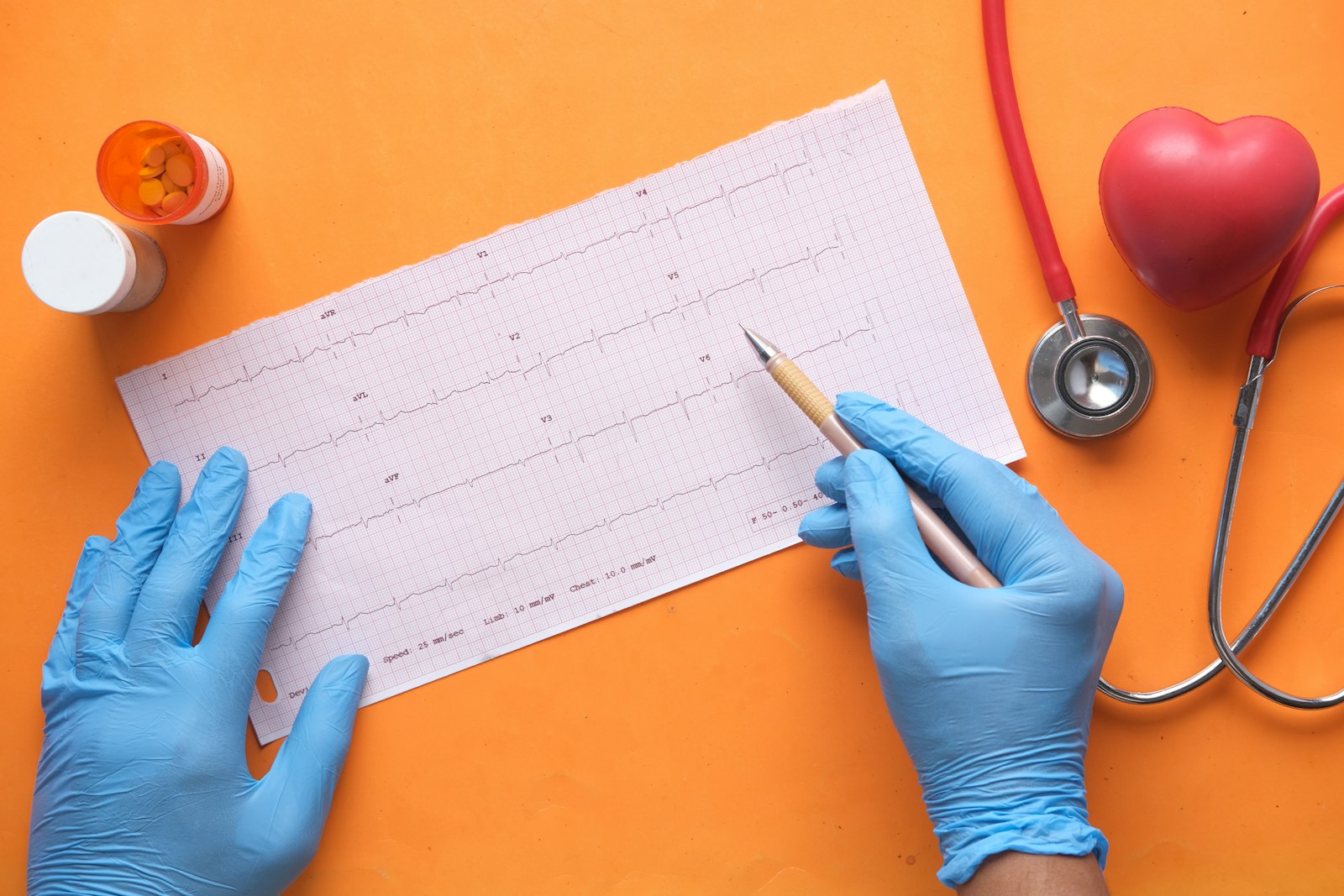Cardiologie consult in ziekenhuis